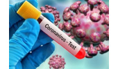 غافلگیری ویروس شناسان و متخصصین عفونی در سراسر دنیا از رفتار ویروس کرونا
